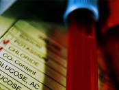 a1c diabetes